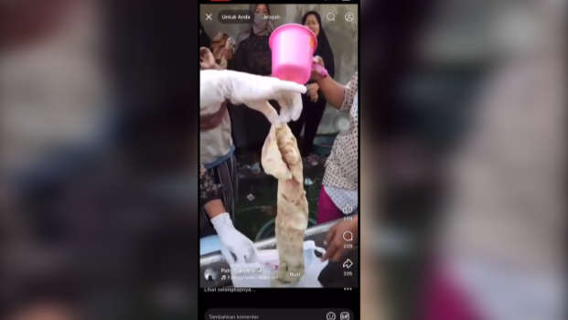 Diduga Adanya Malpraktik, Warga Asal Bekasi Meninggal Dunia Usai Jalani Oprasi di RS Hastien Rengasdengklok Karawang